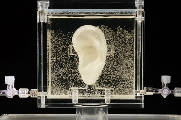 3D-печатное ухо Ван Гога